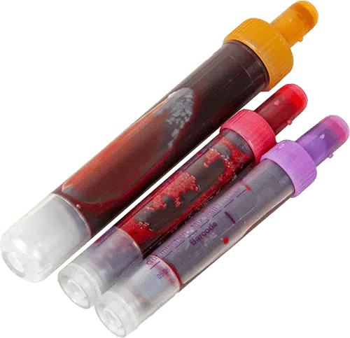 debamed_probengefaess_blut échantillon de sang