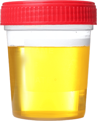 Échantillon d'urine